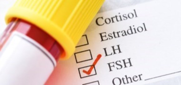 צילום: שאטרסטוק בדיקת Follicle Stimulating Hormone  (בקיצור - FSH) - תמונה